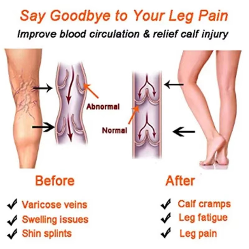 Women Compression Socks Slimmi - Compression Sock Medical 评论和价格